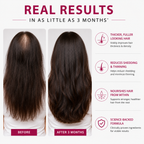 Viviscal Thicker Fuller Hair Growth Supplements for Women, with Biotin and Marine Collagen