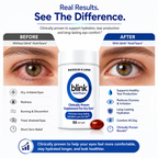 Blink NutriTears – Clinically Proven Dry Eye Supplement