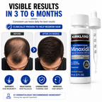 Minoxidil for Men – 6-Month Hair Regrowth Treatment Kit