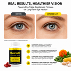 MacuHealth Triple Carotenoid Eye Vitamins+Advanced Vision & Macular Support, 90 Softgels